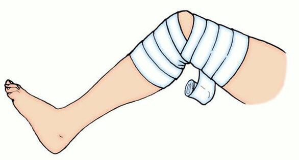 Elastisch verband